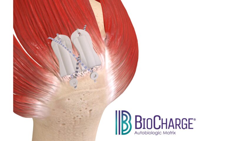 Atreon Orthopedics Announces FDA 510(k) Clearance and Full Market Launch of BioCharge® Autobiologic Matrix for Rotator Cuff Repair